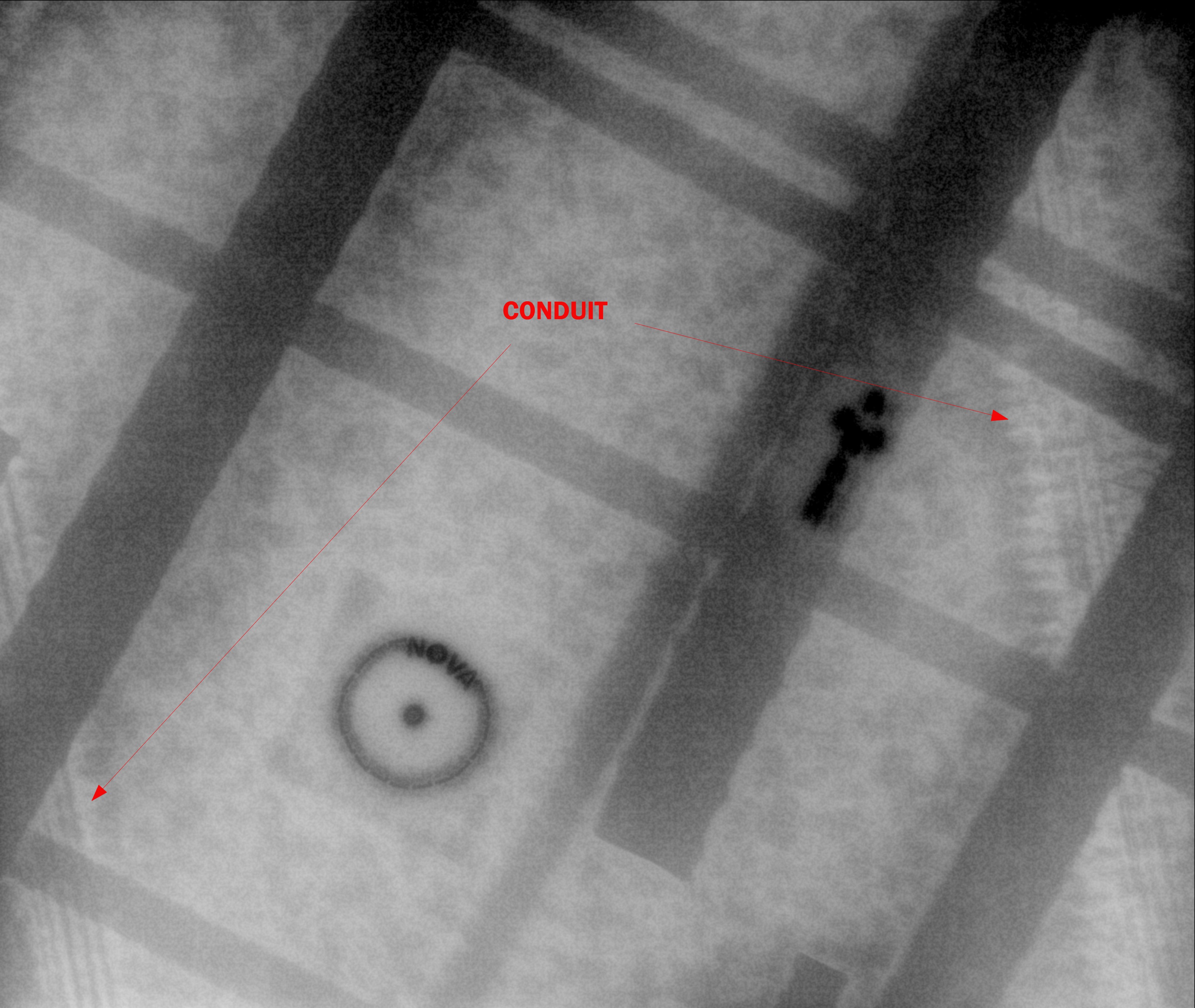 concrete xray with rebar